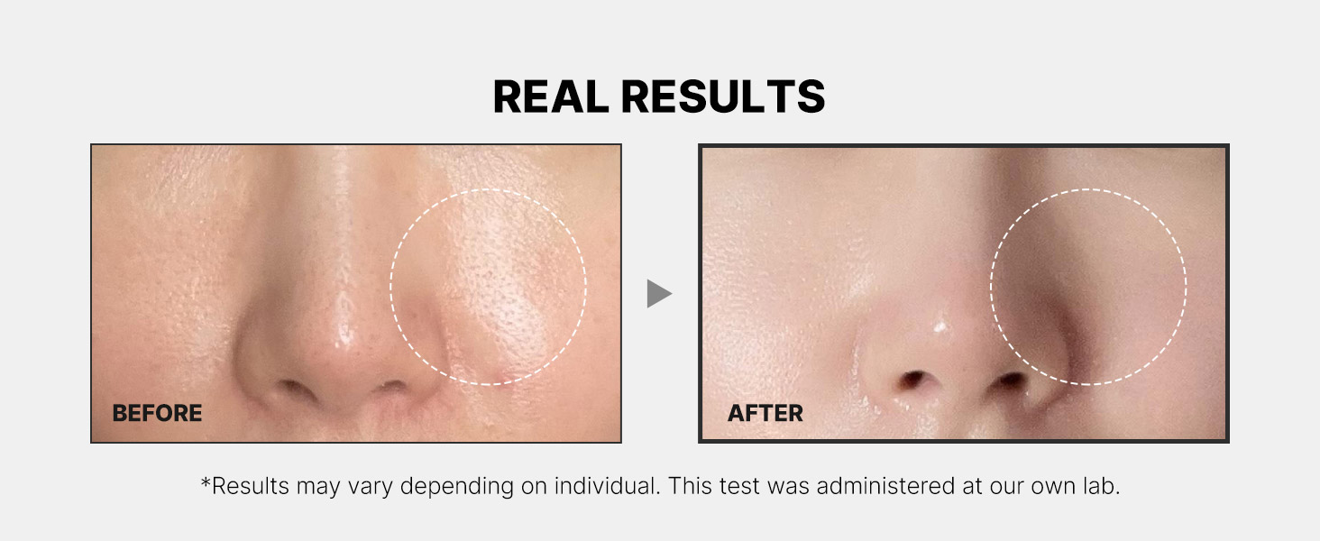 Zero Pore Pad Mild2